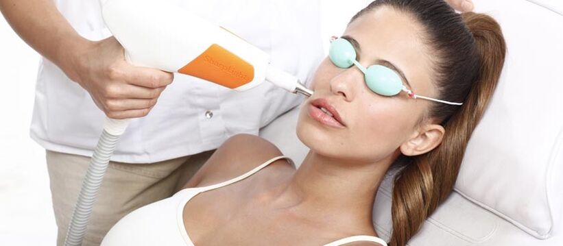 Laserový resurfacing kože